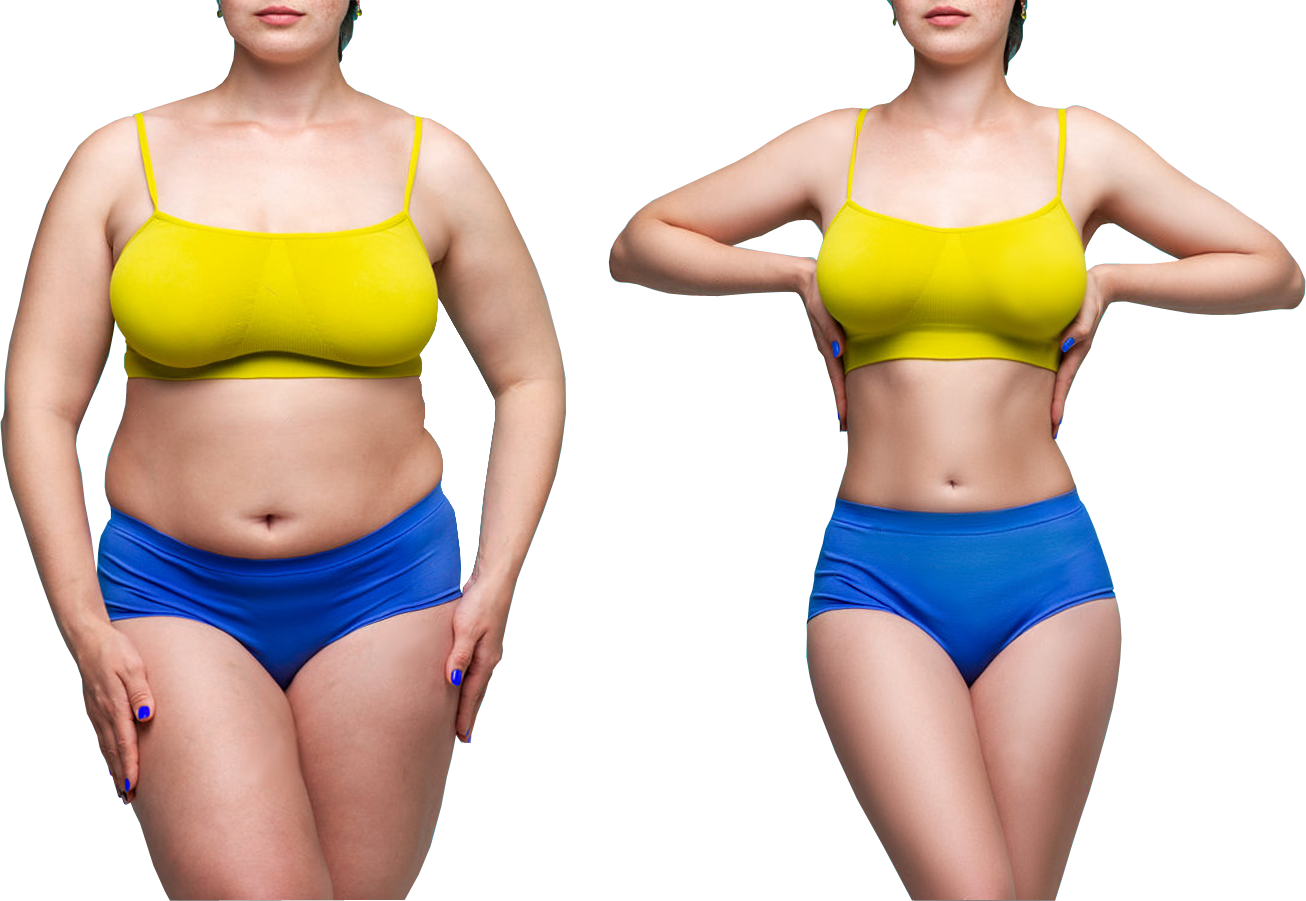 Antes e Depois